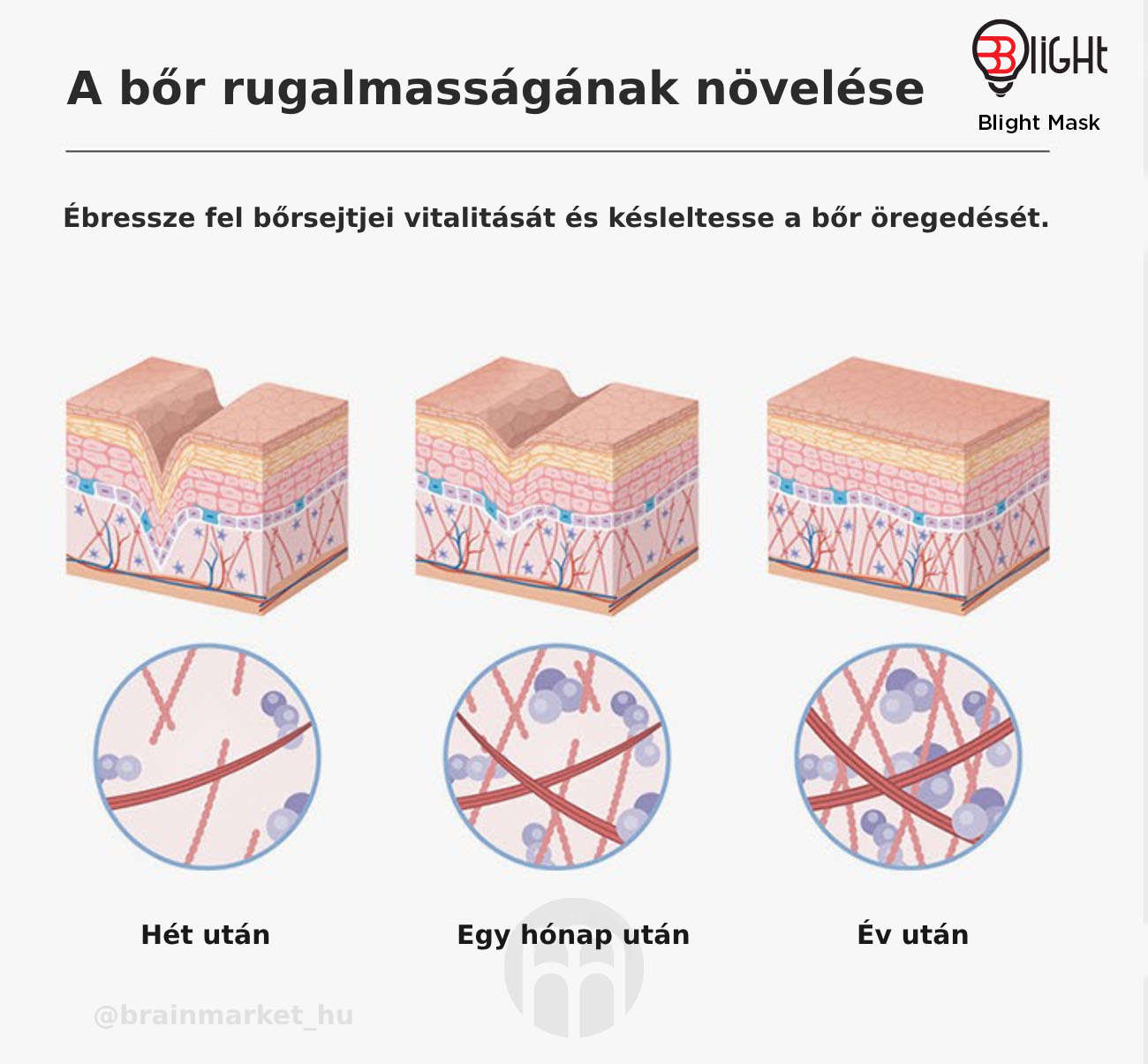 uvolnete-napeti-kuze-brainmarket-hu 